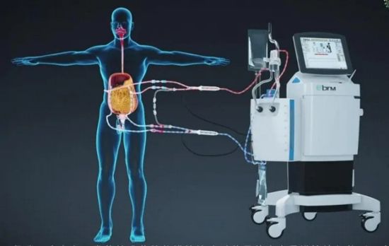 胃癌腹水热灌注效果好吗,胃癌腹膜转移的热灌注化疗