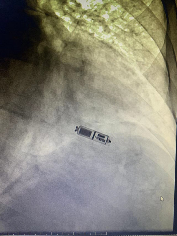 绵阳市第四人民医院在哪里,绵阳第四人民医院地址