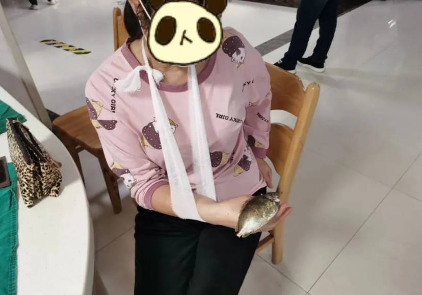 一女子被鱼鳍刺穿手指,一女子被鱼鳍刺伤