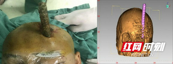 鐮ョ牶瀹炲共涔﹀啓鑽ｅ厜,鐮ョ牶瀹炲共