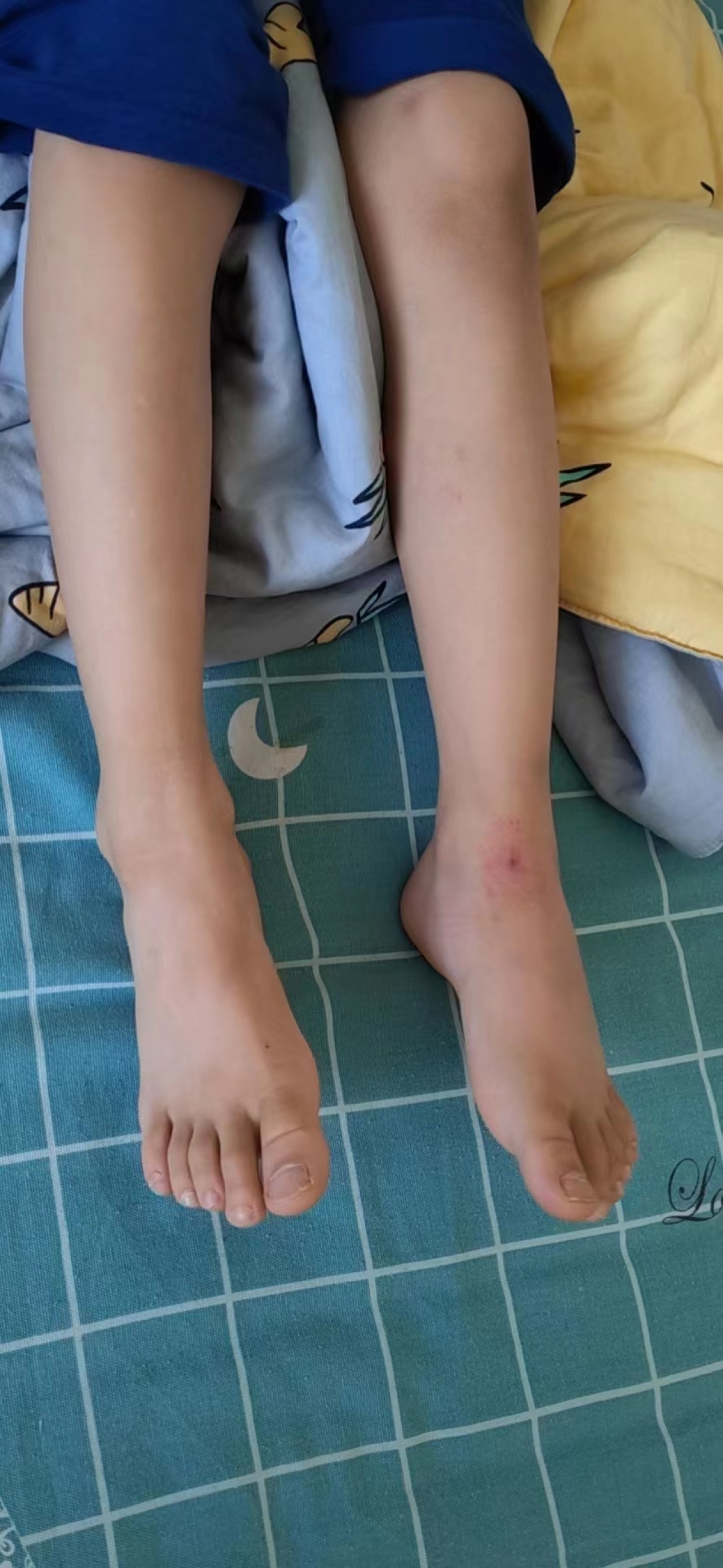 郑州砸伤男童,郑州男子被脱落墙砖砸死