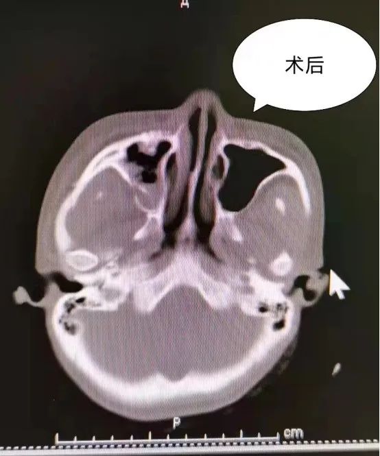 菏泽市立医院口腔科：重塑容颜让美丽依旧