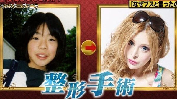 日本网红砸3亿日元整容,砸3亿整容上百次