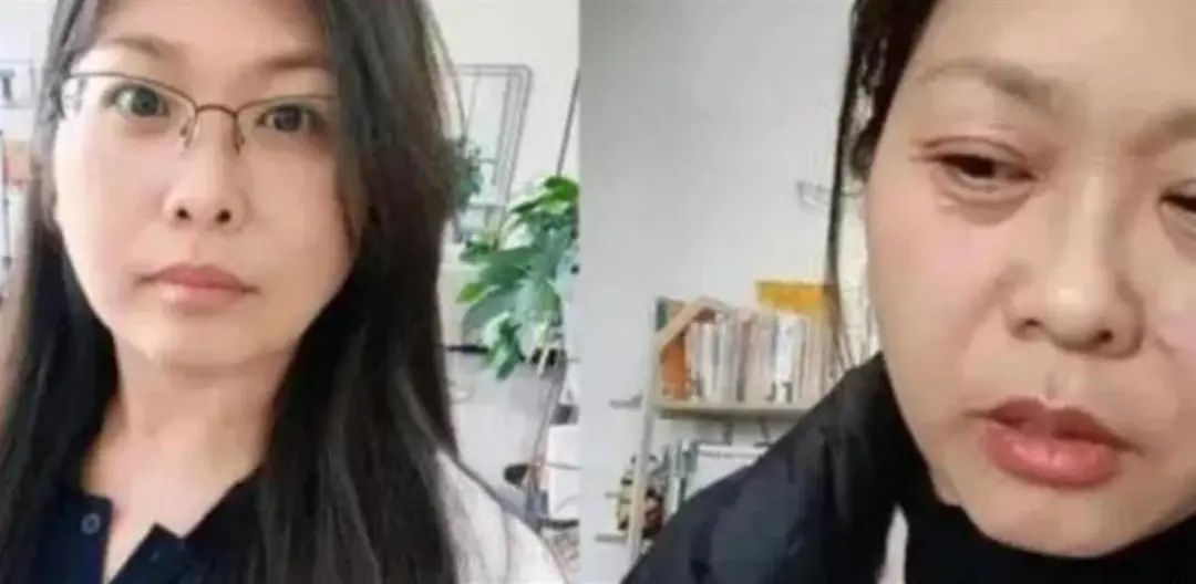 女子因卵巢早衰20天内断崖式衰老,42岁女子20天内断崖式衰老正常吗